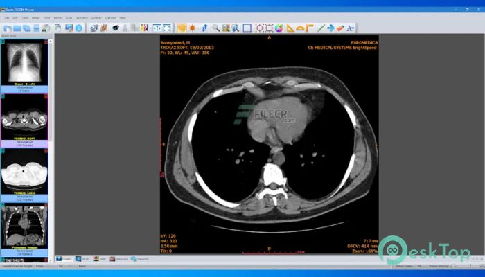 Download Sante DICOM Viewer Pro   14.2.7 Free Full Activated
