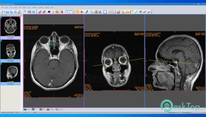 Download Sante DICOM Viewer Pro   14.2.7 Free Full Activated