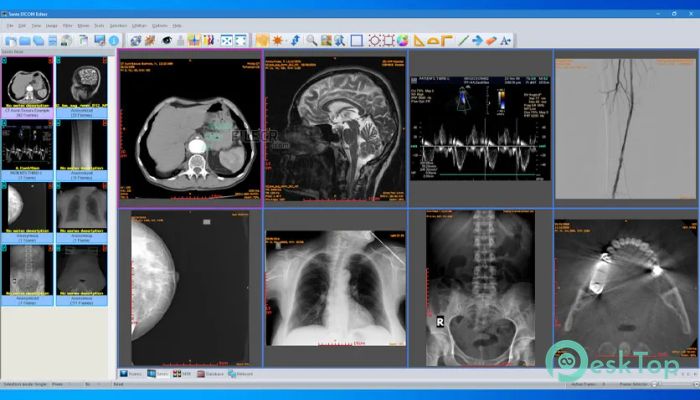 Download Sante DICOM Editor  10.2.7 Free Full Activated